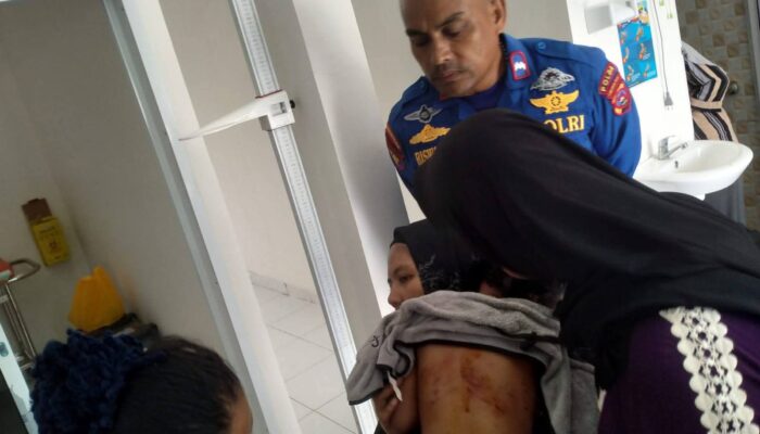 Hati-hati Anjing Liar Berkeliaran di Pantai Air Manis: Seorang Anak Digigit, Pemko Segera Tangkap dan Observasi