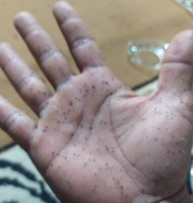 Gunung Marapi Erupsi Lagi, Bukittinggi dan Agam Diselimuti Hujan Abu